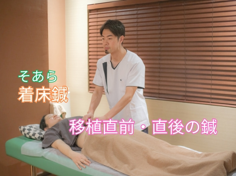 移植直前直後の着床鍼灸